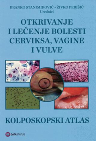 otkrivanje i lečenje bolesti cerviksa, vagine i vulve kolposkopski atlas branko stanimirović živko perišić 